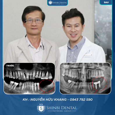 Khách hàng Hữu Khang